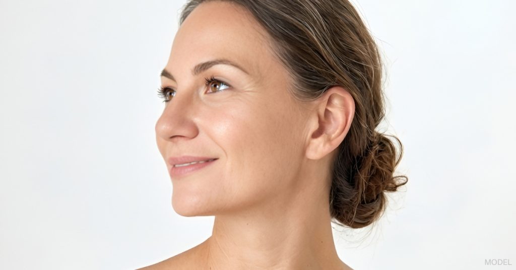 Woman after rhinoplasty. (Model)