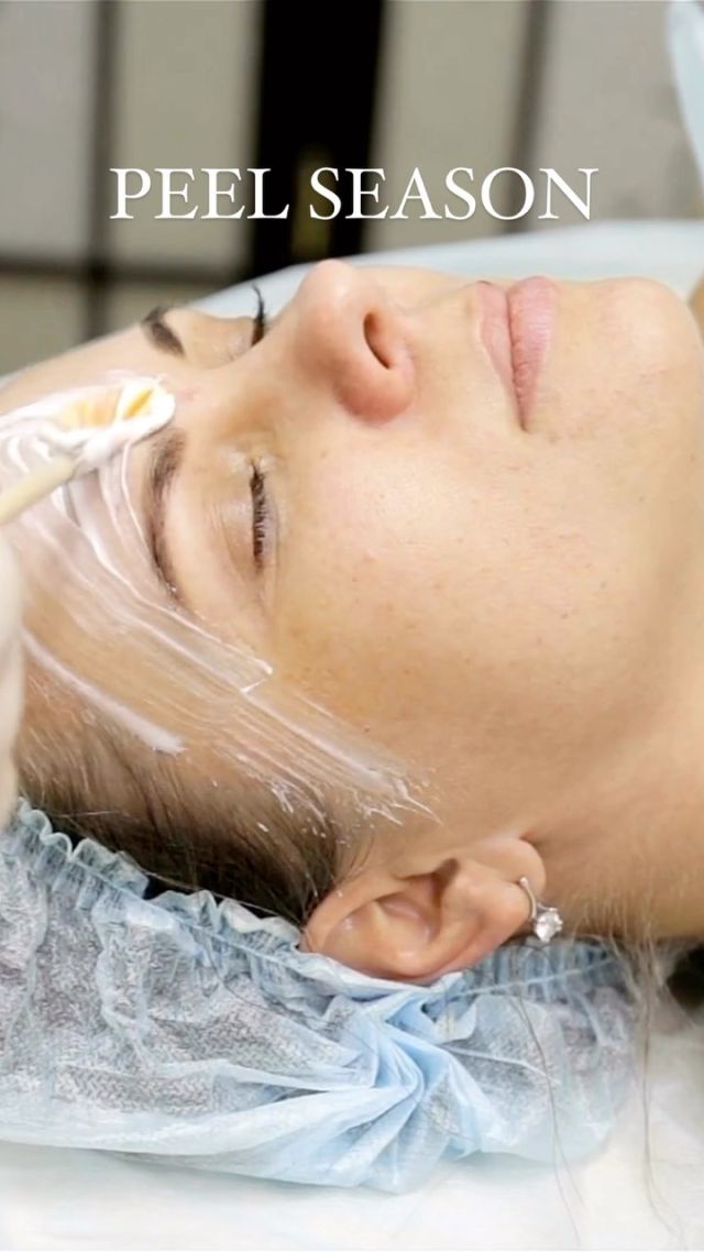 It’s Peel Season at Rosenthal Cosmetic and Plastic Surgery. You don’t realize how much you put your skin through during the summer months so it’s important to “start from scratch” and prep your skin for a busy fall filled with events and outings with a Chemical Peel. Our Medical Esthetician, Jennifer Mignano will discuss the different grades of peels available and will recommend the most beneficial type and strength for your skin. Our safe and effective peels improve overall skin tone and texture while also diminishing age spots, freckles, and hyperpigmentation. These peels can also treat acne, acne scars, redness, and post-inflammatory pigmentation.

Click on the link in our bio to book an appointment with her today! 

#drrosenthal #rosenthalcosmeticandplasticsurgery #southfloridaplasticsurgery #southfloridaplasticsurgeon #palmbeachplasticsurgery #chemicalpeel #peel #facialpeel