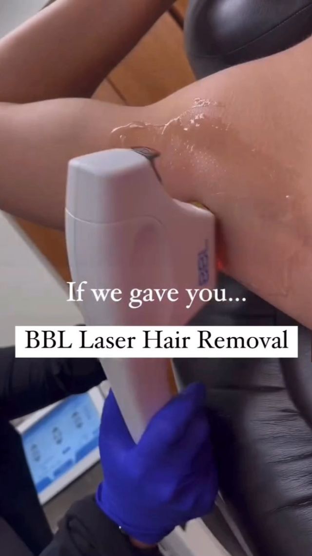 Laser Hair Removal is a life changing treatment you don’t know can’t live without yet. Ask anyone you know who has done it and they will say the same thing. Eight seconds of a pain-free appointment with no downtime is all it takes. Invest in a hair free life today. ⚡️ Schedule an appointment by clicking on the link in our bio. 

#rosenthalcosmeticandplasticsurgery #laserhairremoval #lasertreatment #laserhairremovalinsouthflorida #southfloridamedspa