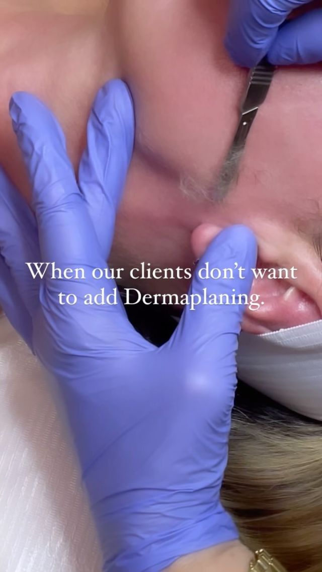 ✨ Don’t let regret overshadow your facial! ✨ Something our clients never regret: adding the transformative power of Dermaplaning to their facial treatments! Say goodbye to dull skin and hello to a radiant complexion with this gentle exfoliation technique.💆‍♀️ Dermaplaning not only removes dead skin cells and peach fuzz but also primes your skin for maximum absorption of skincare products, leaving you with a smoother, brighter canvas. Don’t miss out on setting the perfect tone for your facial experience - click on the link in our bio to book your appointment today with our Medical Esthetician, Cornelia and unlock the secret to glowing, flawless skin! ⬆️ 

#Dermaplaning #FacialEssentials #GlowUpGoals #SkincareRoutine #RosenthalCosmeticAndPlasticSurgery #Facial #FacialsInSouthFlorida #SouthFloridaFacials #SouthFloridaEsthetician