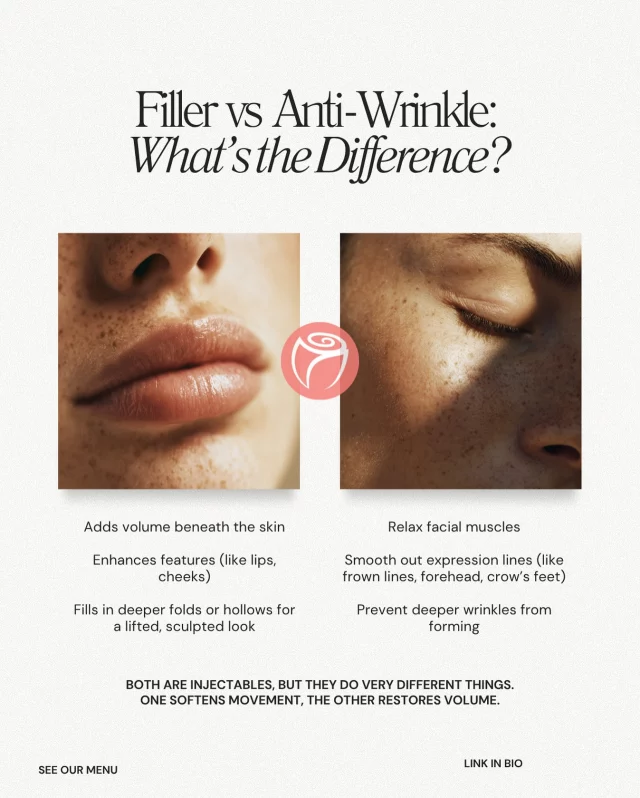 💉 Filler vs. Anti-Wrinkle: What’s the Difference?
 Not all injectables are created equal, and knowing the difference can help you choose the right treatment for your goals.

✨ Filler restores volume, enhances features, and smooths deeper folds. ✨ Anti-Wrinkle (like Botox or Daxxify) relaxes muscles to soften fine lines and prevent future ones.

One restores volume. The other softens movement. Together? Total facial harmony.

📲 Tap the link in bio to explore our injectable menu and book a consultation.

#RosenthalCosmeticAndPlasticSurgery #FacialRejuvenation #BotoxVsFiller #AntiAgingTreatments #Daxxify #NaturalResults #BocaRatonBeauty #PreventativeInjectables #InjectablesExplained #ConfidenceLooksGoodOnYou
