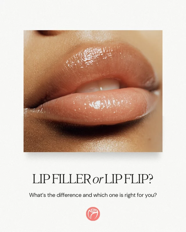 💋 Lip Filler or Lip Flip? Let’s break it down.

Whether you’re after full, sculpted lips or just a subtle boost, we’ve got options:

💉 Lip Filler adds actual volume using dermal filler to enhance shape, balance proportions, and define your pout. ✨ Fully customizable 📆 Lasts 6–12 months

💉 A Lip Flip uses a tiny amount of anti-wrinkle injection above the upper lip to relax the muscle and roll the lip outward. ✨ Great for a soft, subtle enhancement or to reduce a gummy smile 📆 Lasts 2–3 months

Not sure which one’s right for you? We’ll help you decide based on your goals, anatomy, and personal style. Click on the link in our bio to schedule an appointment today! 

#RosenthalCosmeticAndPlasticSurgery #LipFiller #LipFlip #NaturalLips #SouthFloridaAesthetics #PoutPerfection #FillerOrFlip #CustomizedBeauty #SubtleEnhancement #LipGoals #ConfidenceStartsHere