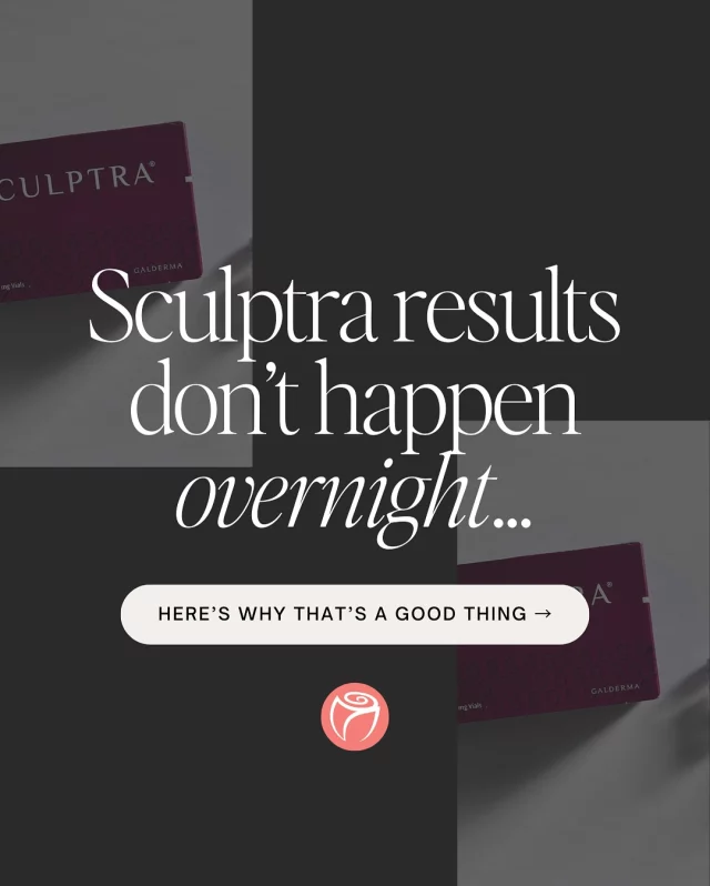 ✨ Sculptra results don’t happen overnight… and that’s the beauty of it. ✨

Unlike instant-fill injectables, Sculptra stimulates your own collagen, creating gradual, natural-looking volume and lift that builds over time.

Here’s what to expect after your treatment:
🗓 Week 1: Temporary swelling fades—this is just the beginning.
🗓 Weeks 4–6: Collagen production quietly kicks in.
🗓 Weeks 8–12: Visible volume and youthful softness begin to show.
🗓 Months 4–6: Peak collagen-building phase.
🗓 2+ Years: Long-lasting lift and subtle refresh—thanks to your own collagen.

This isn’t a quick fix, it’s a long-term investment in your skin’s health, glow, and longevity. ✨

🔗 Click the link in our bio to start your personalized Sculptra journey with Dr. Rosenthal today.

#SculptraResults #RosenthalResults #CollagenBoost #NaturalLift #FacialRejuvenation #AntiAgingSkincare #WestportCT #SkinConfidence #LongLastingGlow #SculptraJourney #RosenthalCosmeticAndPlasticSurgery