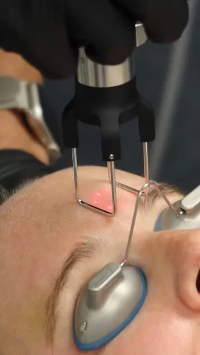 CO2 laser treatments are one of the most effective ways to improve skin quality at a deeper level.

By stimulating collagen production and resurfacing the skin, CO₂ laser treatments help reduce fine lines, wrinkles, sun damage, uneven texture, and acne scarring. The result is smoother, firmer, more even-looking skin that continues to improve over time as collagen rebuilds.

This treatment is ideal for patients looking for long-term skin rejuvenation with noticeable, lasting results. When performed by an experienced, board-certified team, CO₂ laser resurfacing is both precise and highly effective.

Schedule a consultation to learn if CO₂ laser treatment is right for your skin goals.

#RosenthalCosmeticAndPlasticSurgery #CO2Laser #SkinResurfacing #LaserTreatments #CollagenBoost