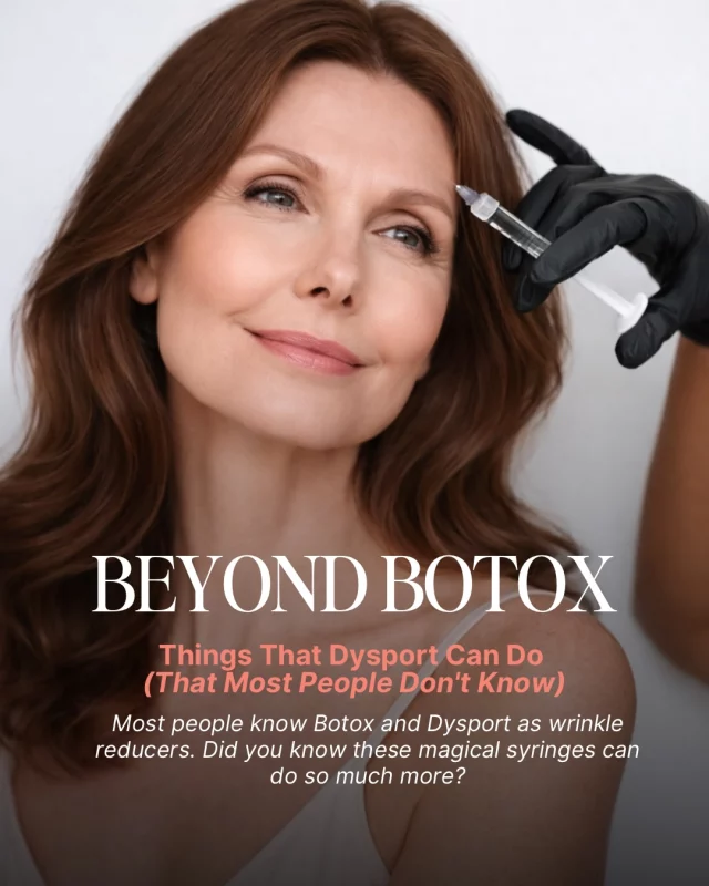 Beyond Botox… ✨ there’s a reason Dysport is one of our favorite treatments at Rosenthal Cosmetic & Plastic Surgery.

From smoothing fine lines to refining the neck, contouring the jawline, and even reducing excessive sweating, Dysport goes far beyond wrinkles to enhance your overall confidence and profile.

Subtle. Strategic. Beautifully natural results.

Ready to see what Dysport can do for you?
Tap the link in our bio to book your consultation. 💫

#RosenthalPlasticSurgery #Dysport #NaturalResults #AestheticMedicine #BeautyRefined